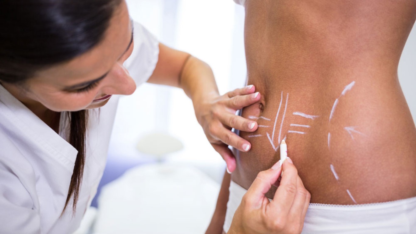 Alles, was Sie über Lipoabdominoplastik wissen müssen