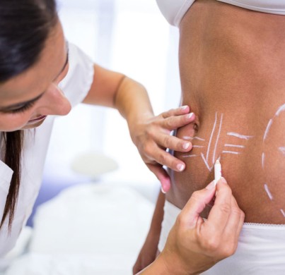 7 choses à savoir avant de subir une abdominoplastie
