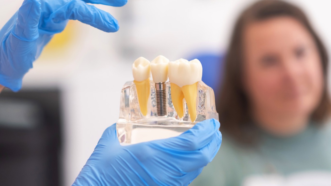 Todo lo que necesitas saber sobre los implantes dentales All on 6 en Turquía