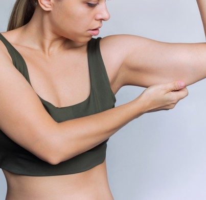 ¿Deberías esperar para hacerte un lifting de brazos (braquioplastia)?