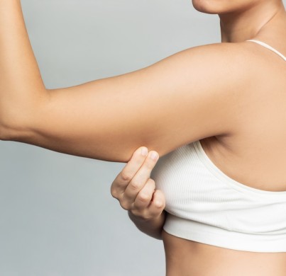 Arm Lift (Brachioplasty)