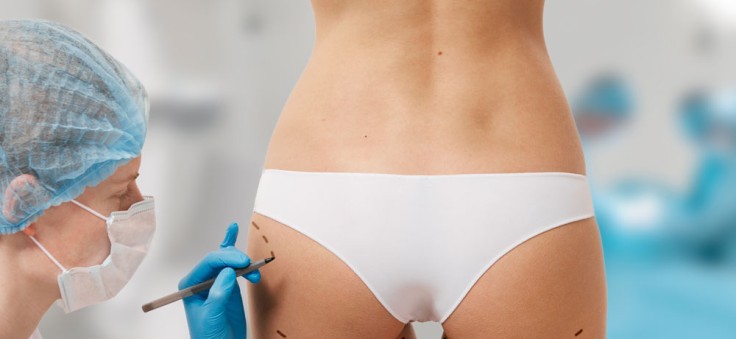 Questions essentielles à poser lors d'une consultation pour une chirurgie BBL