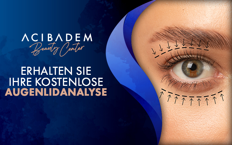 WAS SIE-UBER-DIE-VORBEREITUNG-EINER-AUGENLIDOPERATION-WISSEN-SOLLTEN