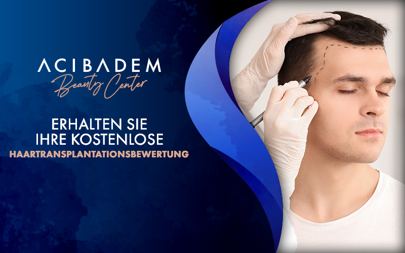 HAARTRANSPLANTATION MYTHEN-VS-FAKTEN-WAS-SIE-WISSEN-SOLLTEN
