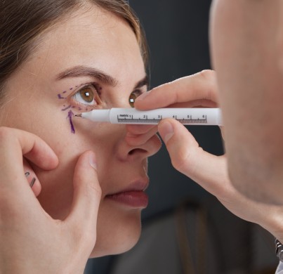 ¿Por qué elegir ACIBADEM para una blefaroplastia?