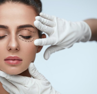 Blepharoplasty (Eyelid Surgery)