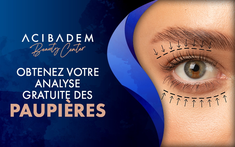 COMMENT SE-PREPARER-A-UNE-CHIRURGIE-DE-BLEPHAROPLASTIE