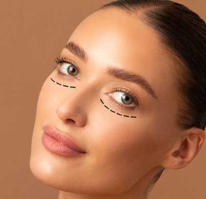 Blépharoplastie : 7 questions à poser avant de se lancer