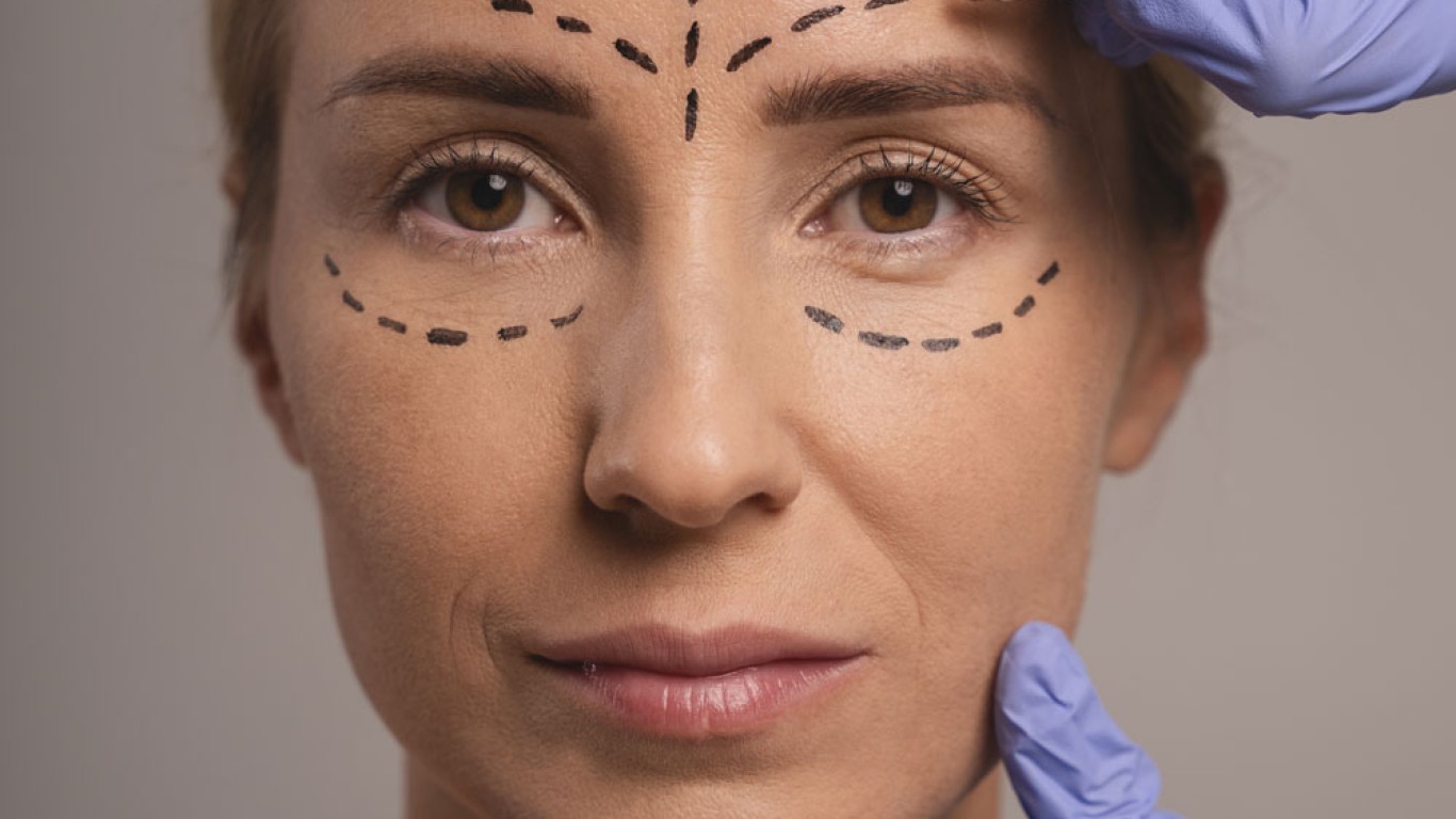 Asymmetrical Eyelids and How Surgery Can Correct Them