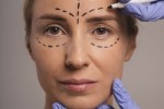 Asymmetrical Eyelids and How Surgery Can Correct Them