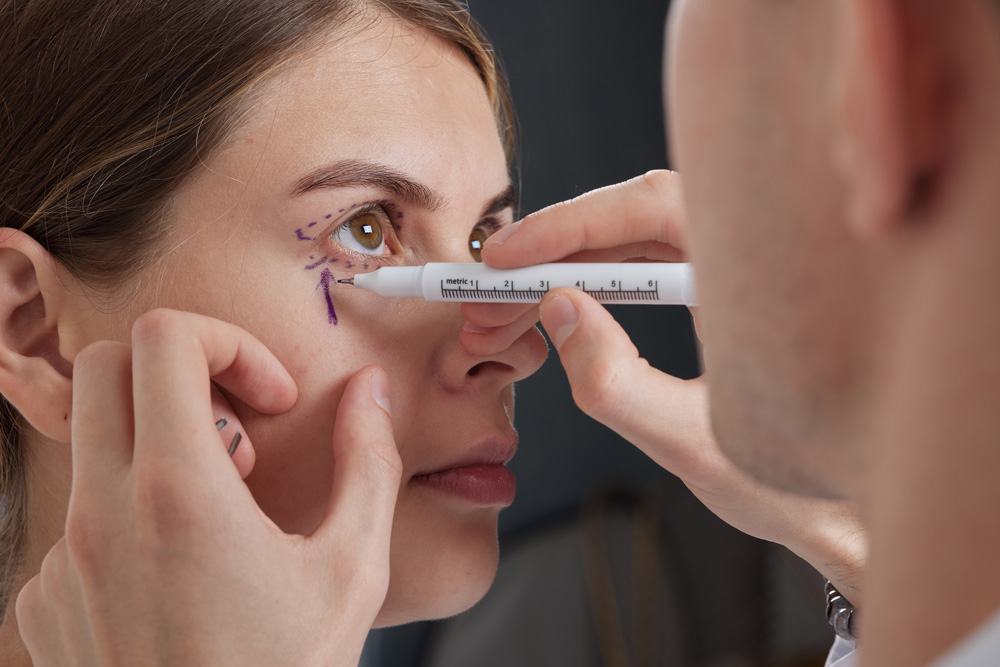 La blépharoplastie (Chirurgie esthétique des paupières)