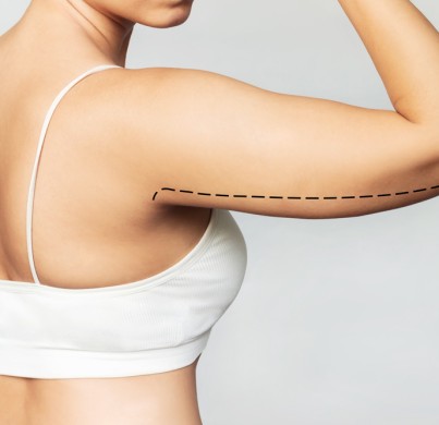 Consejos de Recuperación de Braquioplastia que Más Ayudan