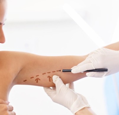 Todo lo que debes saber sobre la braquioplastia