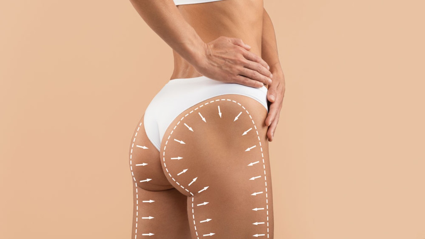 Brazilian Butt Lift: When Will You See Curves?