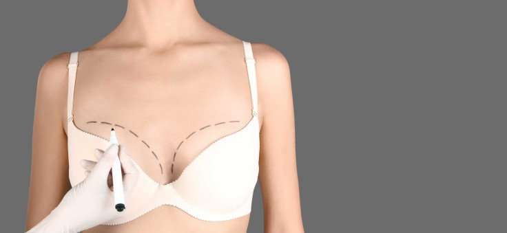 What Is Breast Augmentation