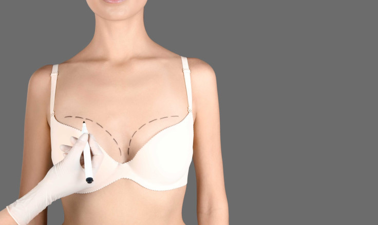 What Is Breast Augmentation