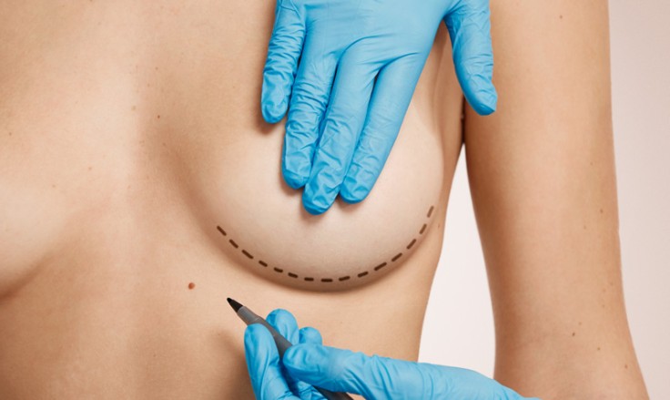 Breast Lift In Turkey: Procedure, Cost, Benefits