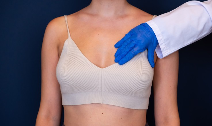 Breast Reduction Scar Care That Really Works