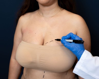 Everything You Need to Know About Breast Surgery