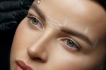 How Brow Lift Surgery Opens the Upper Face