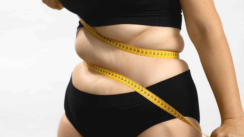 Morbid Obesity: Treatment Options and When Surgery Helps