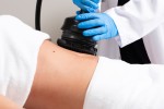 Cellulite Treatment That Patients Choose Most in 2025