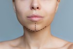 Popular Lip Surgery Options to Reshape and Enhance