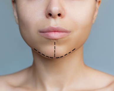 Popular Lip Surgery Options to Reshape and Enhance