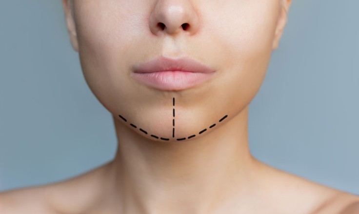 Popular Lip Surgery Options to Reshape and Enhance