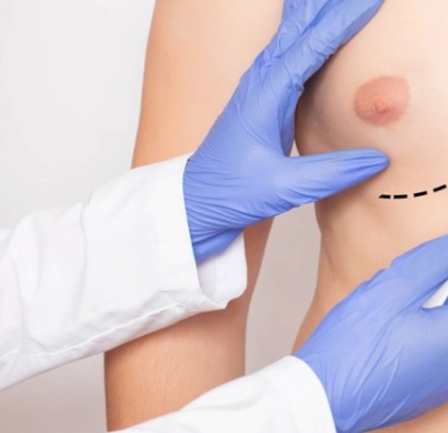 Aprende más sobre la cirugía ginecomastia