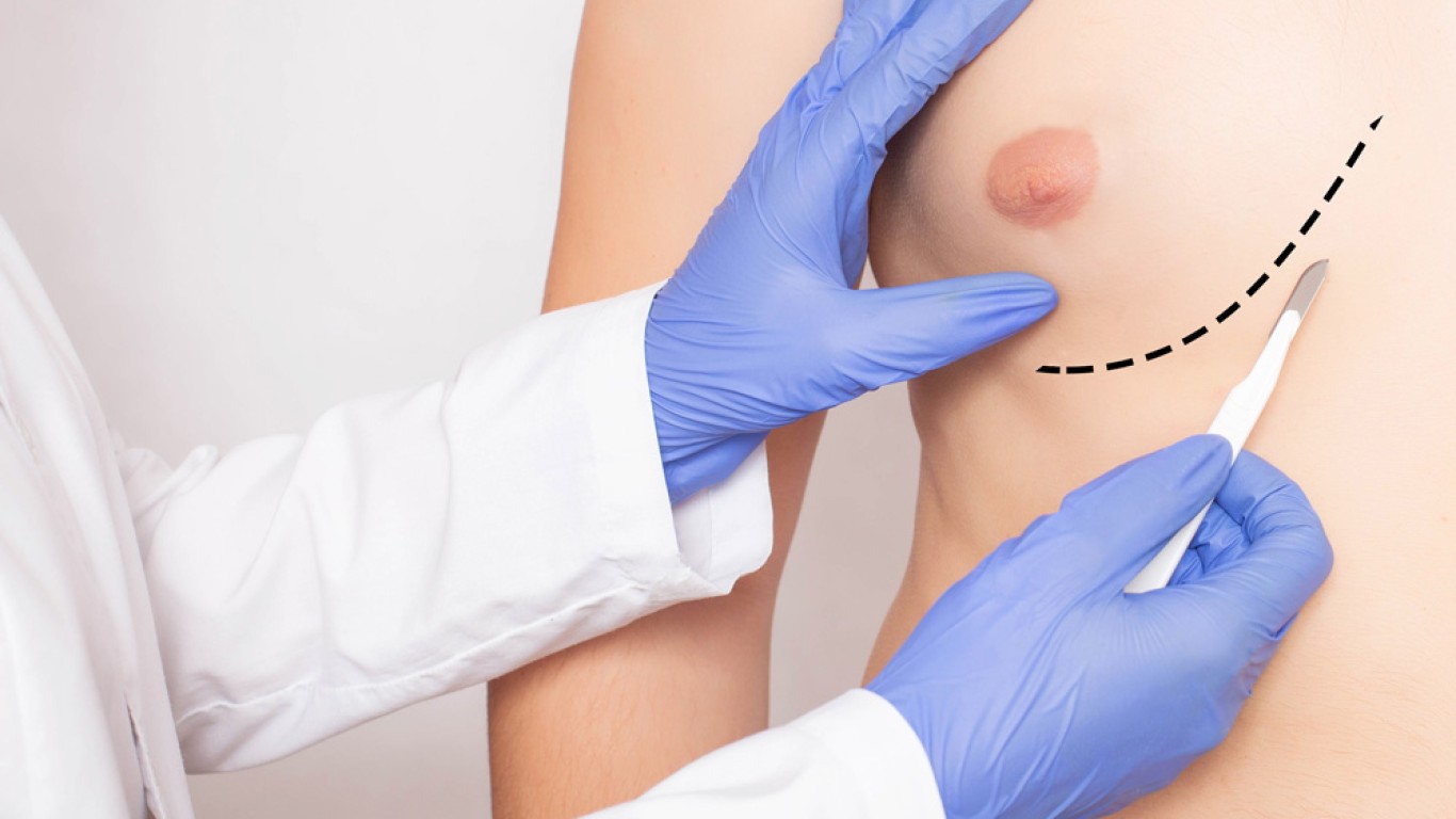 Los 5 procedimientos de cirugía plástica más populares entre los hombres