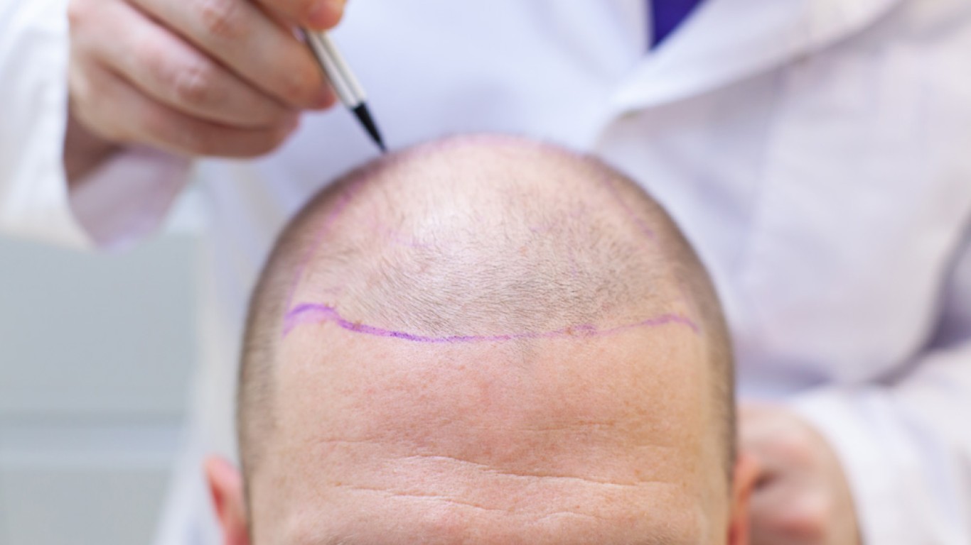 DHI vs. FUE: Which Hair Transplant Method Is Right for You?