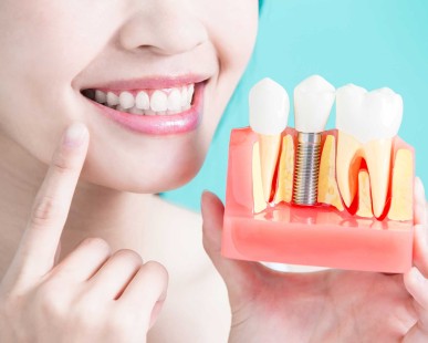 Dental Implants in Turkey: What’s Included in Cost