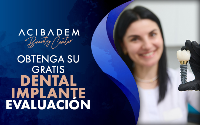 TODO LO-QUE-NECESITAS-SABER-SOBRE-LOS-IMPLANTES-DENTALES-ALL-ON-4