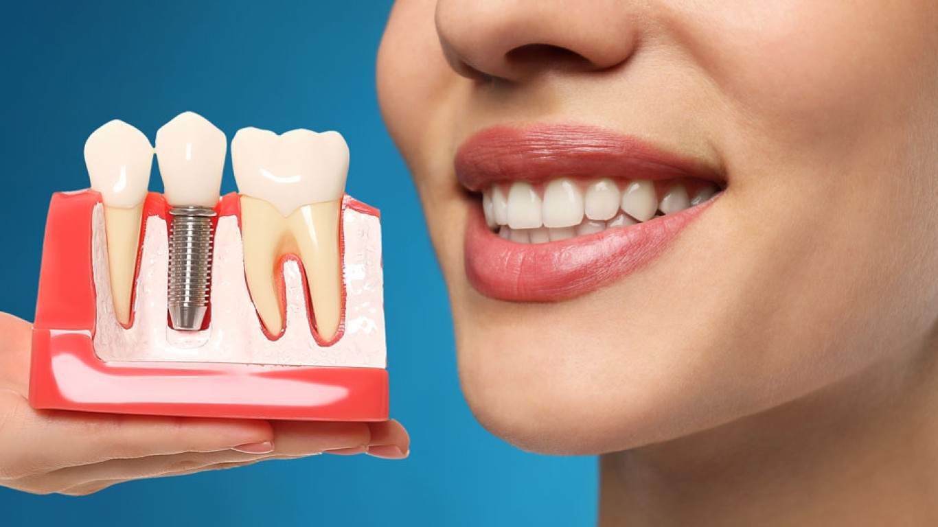 7 claves antes de ponerte implantes dentales en el extranjero