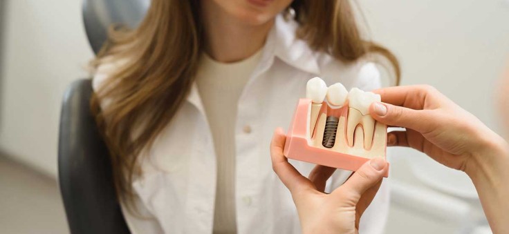 When Is the Best Time to Get Dental Implants?