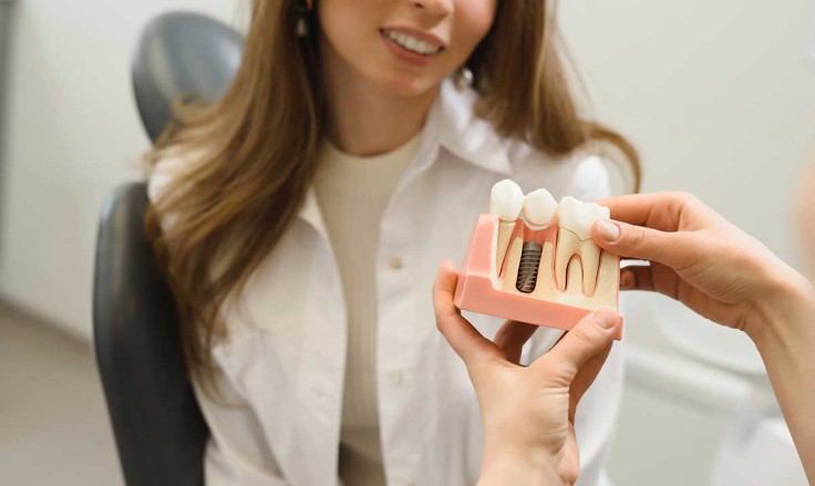 When Is the Best Time to Get Dental Implants?