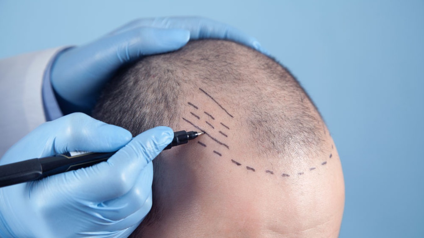 DHI Hair Transplant Turkey: Procedure, Cost