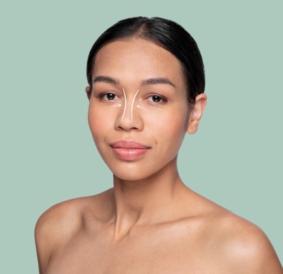 What to Expect From Ethnic Rhinoplasty