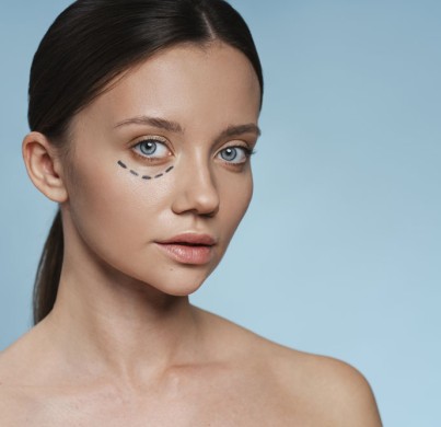 Blépharoplastie : 5 questions à se poser!
