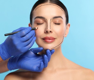 Face Lift (Rhytidectomy)