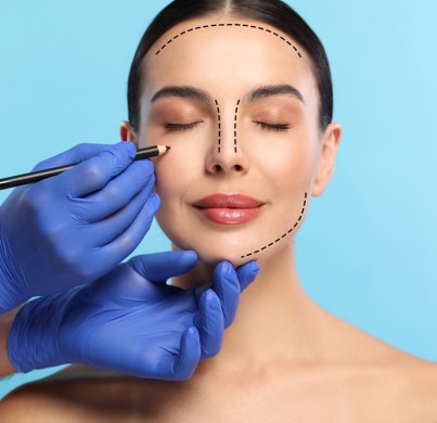 Face Lift (Rhytidectomy)