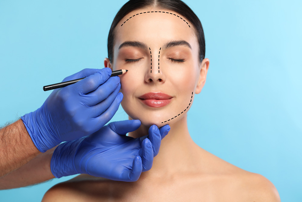 Face Lift (Rhytidectomy)