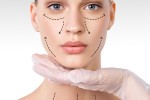 Vampire Facial: What PRP Microneedling Does for Skin