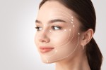 8 Advantages of Undergoing Rhytidectomy in Istanbul