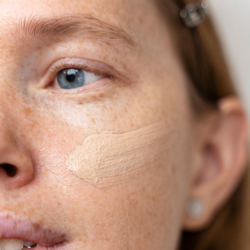 Freckle Removal Treatments