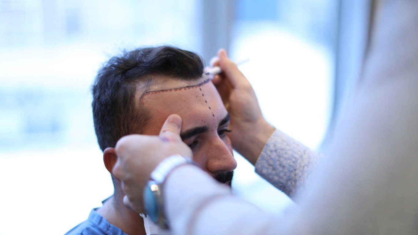 The Future of FUE: Must-Know Trends for 2025