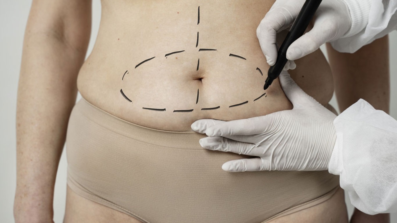 ¿Es suficiente una mini abdominoplastia o necesitarás algo más?