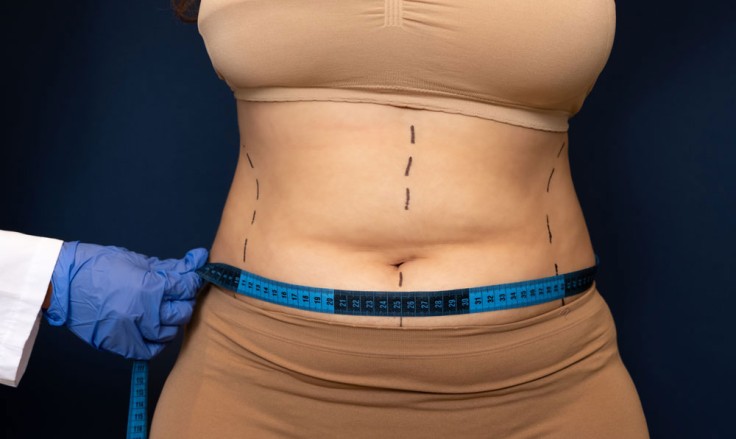 Full Tummy Tuck vs Mini Tummy Tuck: What's The Difference? 