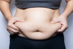 Gastric Sleeve in Turkey: What to Expect, Procedure, Cost